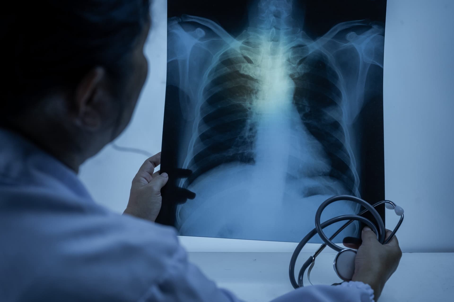 Missed Heart Attack in the ER: Oregon Malpractice Basics